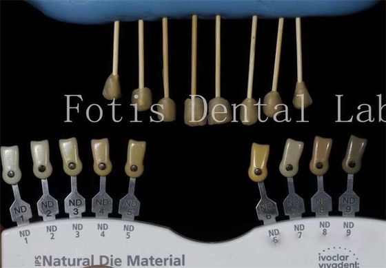 Duurzame 0,3-0,5 mm dikke tandheelkundige lab veneers valse veneers voor tanden