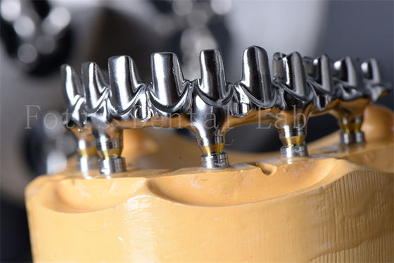 Langdurig Titanium / Zirconia All On 4 All On 6 Implantaten Geen leeftijdslimiet
