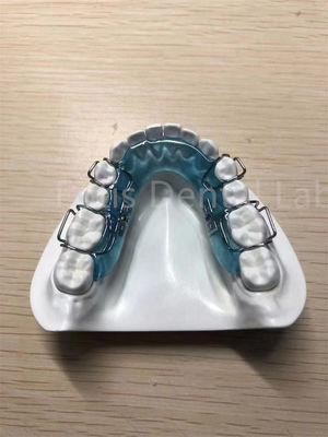 Verstelbare retainer gehemelte expander Veilig Comfortabele tandbehoud oplossing