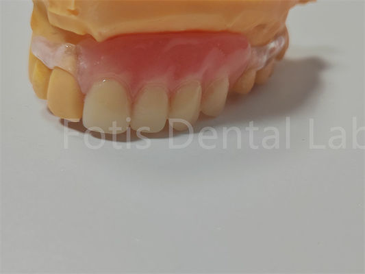 FDA/ISO-certificering TCS Valplast Flexible Protheses Makkelijk te reinigen Aanpassen
