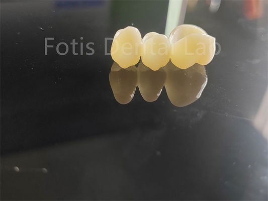 Tandheelkundige industrie Zirconia gelaagd met porselein Langdurige oplossing