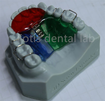 Aanpasbare en verstelbare orthodontische expander voor effectief behoud van tanden