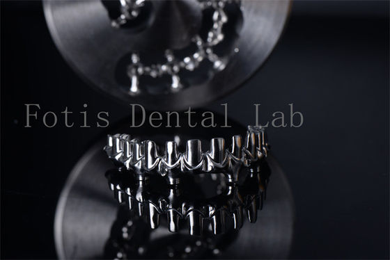 kopen Gemakkelijk schoon te maken All On 4 En All On 6 Implantaten Professionele online manufacture