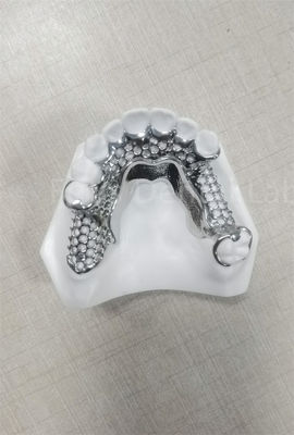 kopen Hoge stabiliteit Flexible gedeeltelijke tandheelkunde Gemakkelijk schoonmaken Regelmatig onderhoud online manufacture