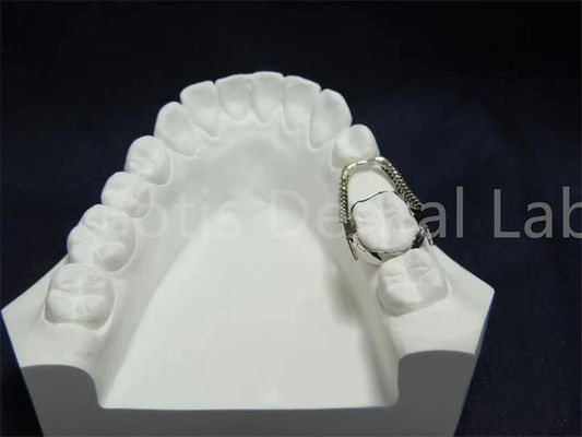 kopen Verstelbare retainer expander handige orthodontische oplossing eenvoudig onderhoud online manufacture