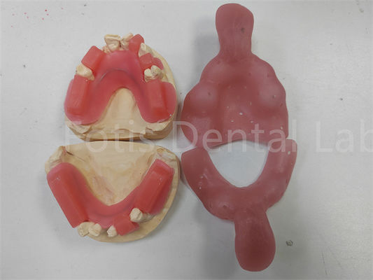 kopen Vibrant rode gebitsgordels voor bovenste of onderste tanden Glanzende afwerking Lichte ponden online manufacture
