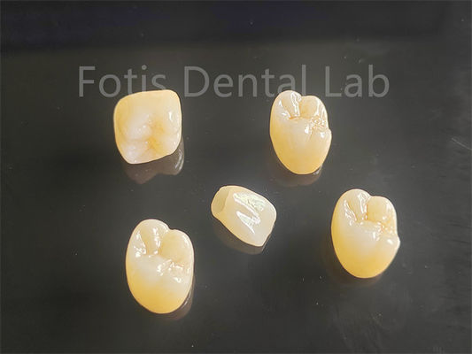 kopen Aesthetische aantrekkingskracht Volledig porselein gelaagd zirconia ideaal voor kronen bruggen online manufacture