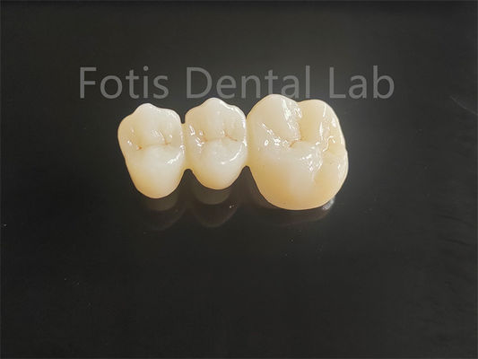kopen Hoge sterkte porselein gelaagd zirconia voor langdurige gebitbruggen online manufacture