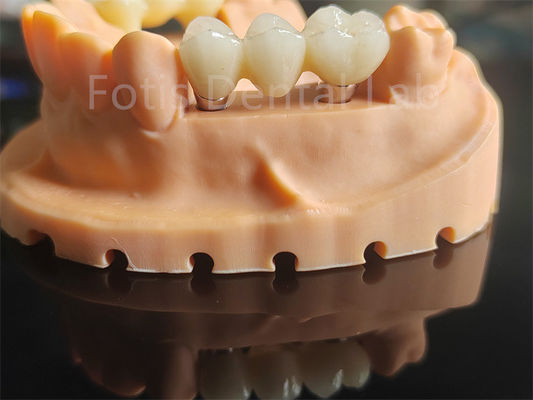 kopen Materiaal van keramiek op basis van zirconia met een hoge hardheid voor tandheelkundige toepassingen online manufacture