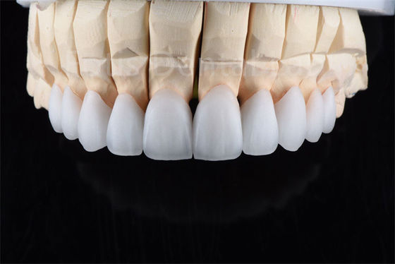kopen Kraakbestendigheid Zirconia Meerlaagse Keramiek Ultieme oplossing voor industriële efficiëntie online manufacture