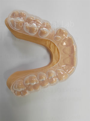 kopen Hygiënische Hard Soft Night Guard Bescherming tegen bruxisme Geurloos online manufacture
