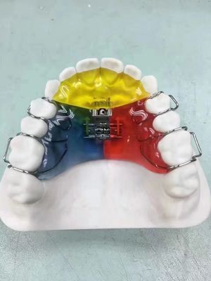 Nance / Hyrax / Rapid Palatal Expander Night Guard Space Keeper OEM Veilig te gebruiken