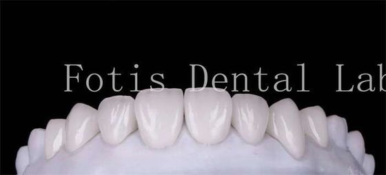 Polijst Finishing Cosmetische Tanden Veneer Covers voor een mooie glimlach
