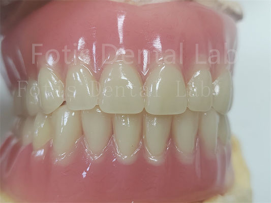 Comfort Custom Fit Full Acrylic Prothesis voor precieze tandprothesen