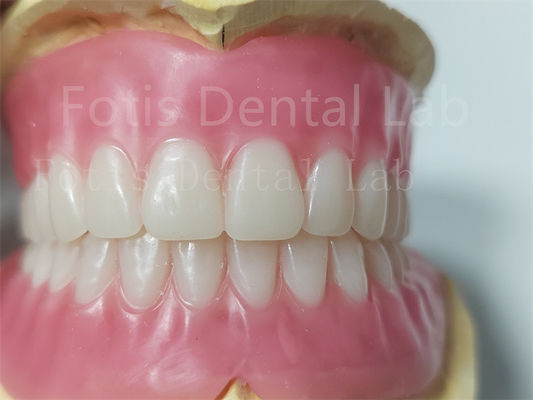 Duurzame natuurlijke kleur Full Acrylic Prothese Geurloze aanpassing