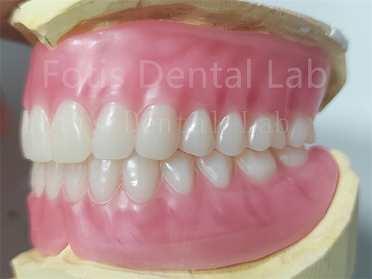 OEM Volledige bovenste en onderste acrylprothese Vlekwerend Natuurlijke kleur