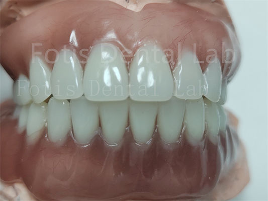 Comfortabele volledige bovenste acrylprothese Volledige acrylprothese met ivoclare tanden