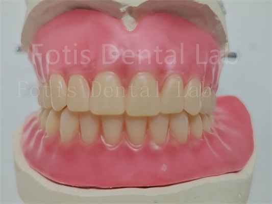 Goedkope aangepaste volledige acrylprothese met Ivoclar tanden gemakkelijk te gebruiken