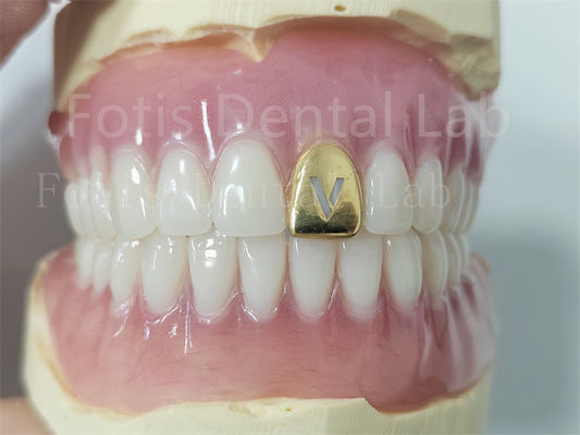 Comfortabele, nauwkeurige, volledige acrylprothese met natuurlijke tanden