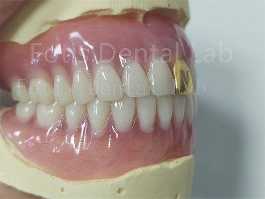Esthetiek Complete Acryl Prothese Set Aanpasbaar Pas Makkelijk te reinigen