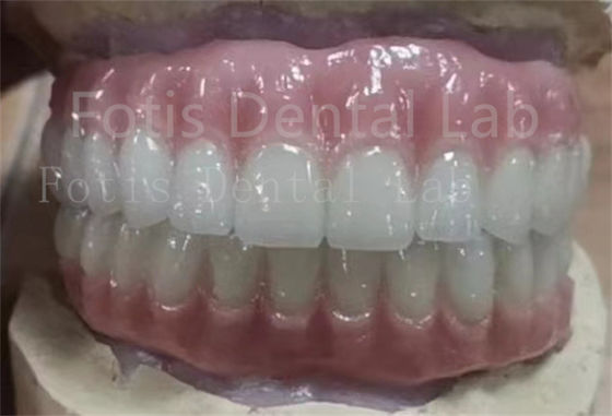 Precieze pas Ivoclar Tanden Acryl Complete Prothese Vlekbestendig