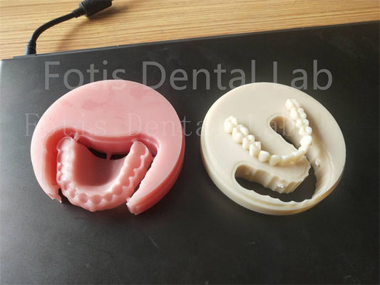 Comfort Fit Full Acrylic Tandheelkundige Prothese Voor Professionele Technici Gemakkelijk Te Reinigen