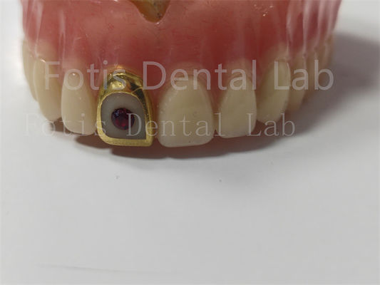 Comfortabele volledige acryl tandheelkunde voor professionals Vlek- / geurbestendige