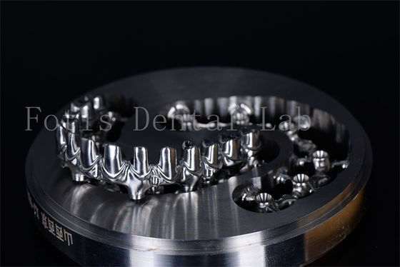 Natuurlijke uitstraling Zirkonium of titanium implantaten Permanente oplossing