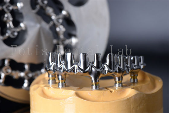 Minimaal invasieve herstel kauwen alle op 4 alle op 6 Titanium of Zirconia tanden