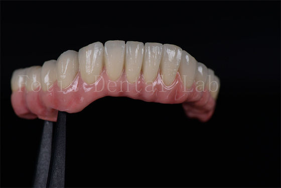 Hoog succespercentage Alle op vier Alle op zes Zirconia Titanium tandheelkundige implantaten op maat