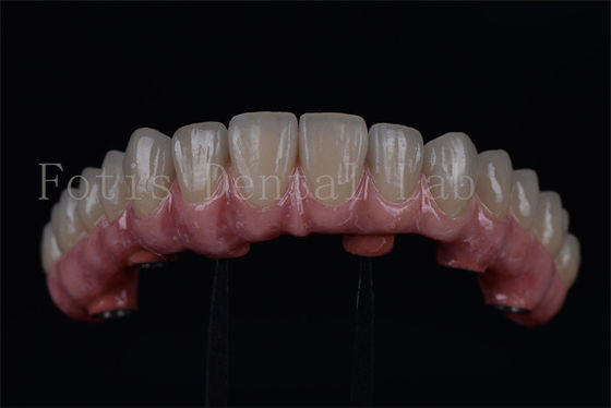 Langdurig Titanium / Zirconia Alle op 4 Alle op 6 Snel herstel 1-2 weken