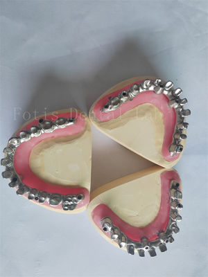 De perfecte oplossing voor tandheelkundige implantaten.