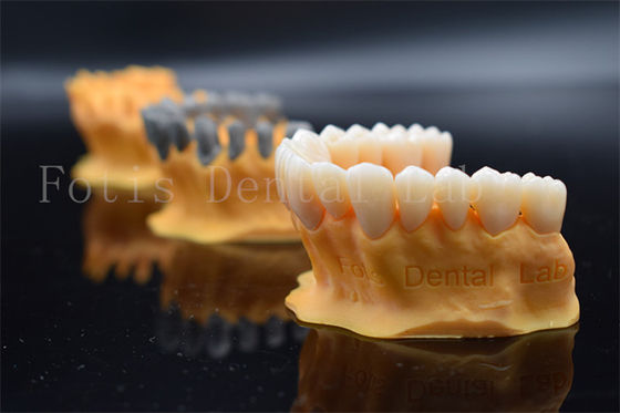 Snel Full Ziconia Design Digitale kronen 3 Shape / Exo Design Zelfde dag productie