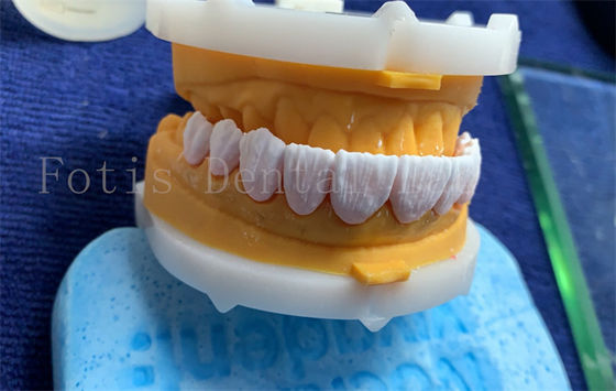 Geavanceerde digitale tandheelkundige kronen Implantat Dentrue Kroon FDA/ISO/CE gecertificeerd