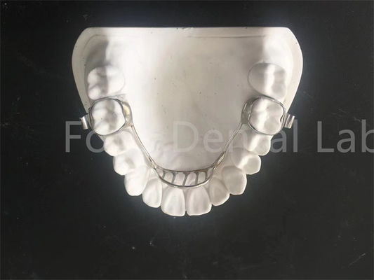 Aanpasbare expanderende behuizing Palatal Expander behuizing Gemakkelijk onderhoud