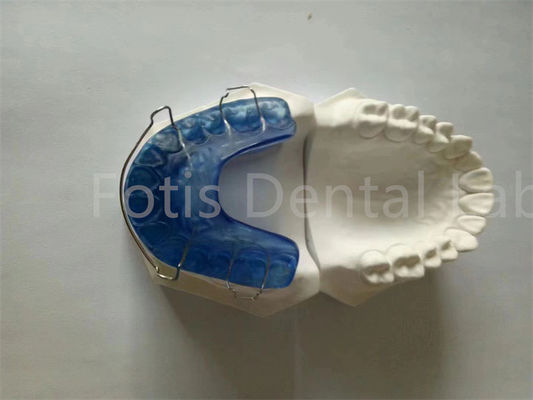 Gemakkelijk te dragen Rapid Palatal Expander Retainer voor hygiëne en comfort