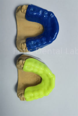 Geavanceerde orthodontische retainer expander voor precieze en comfortabele behandeling