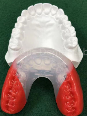Medisch geschikte orthodontische beugels voor een perfecte tandbalans