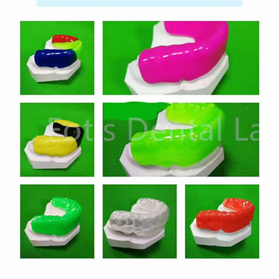 Medische kwaliteit orthodontische aligners Topklasse orthodontische aanpassing