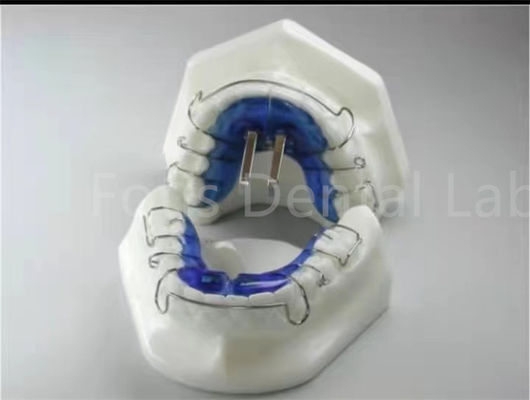 Orthodontische behandeling Retentier Expander voor precieze tandbalans