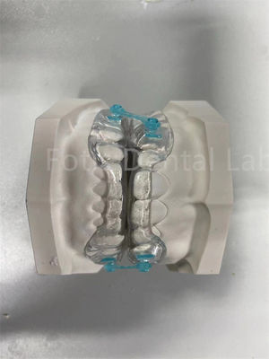 Professionele Comfortabele Fit Retainer Expander Orthodontic Correction Device