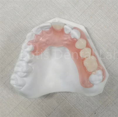 Roze/transparante TCS Valplast Geurbestendige Flexibele Tandprothese