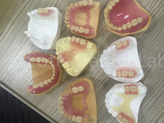 Flexibel TCS Valplast Afneembare gedeeltelijke prothese gemakkelijk in te stellen