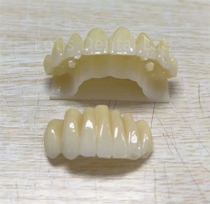 Precision Zirconia Multilayer Product voor het verbeteren van breukbestendigheid