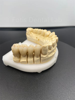 Goed functionerend tandheelkundig zirconia meerlagig De ultieme keramische oplossing