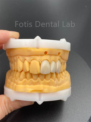Hoge duurzaamheid Meerlaagse Zirconia tandheelkundige keramiek voor tandheelkundige laboratorium medisch product
