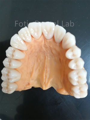 Geavanceerd meerlagig zirconia voor superieure slijtvastheid en corrosiebestendigheid