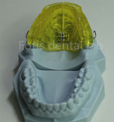 Aanpasbare orthodontische beugel voor China tandheelkundig laboratorium