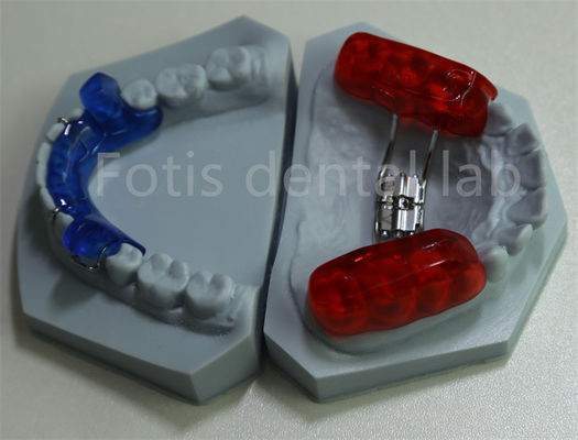 Effectief tandbehoud tandheelkundig laboratorium orthodontisch ruimtebewaker voor het uitbreiden van tanden