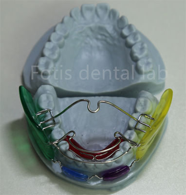 Tandheelkundig laboratorium Orthodontic Palatal Expander Veelschichtig en effectief voor het uitlijnen van tanden